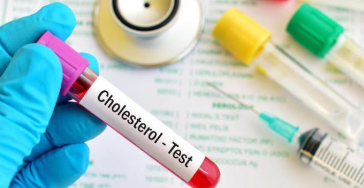 Que signifie vraiment l&rsquo;augmentation du cholestérol ?