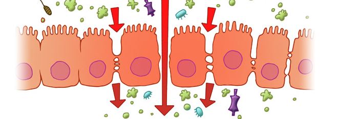 Le syndrome de l&rsquo;intestin perméable